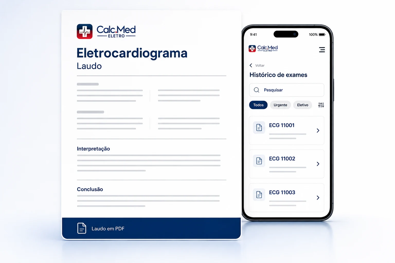 Composição ilustrativa de laudo em PDF e histórico de exames da CalcMed Eletro, sem dados de pacientes.